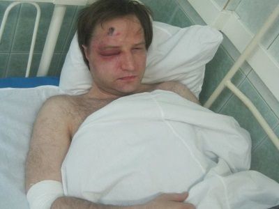 Евгений Куракин после избиения. Фото: Дмитрий Сотников